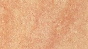Quarzite Rosa Diamante Granite